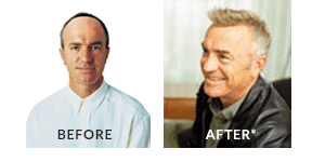 Advanced Hair Studio - Hair Loss & Regrowth Treatment Clinic Australia Advanced Hair Studio - Hair Loss & Regrowth Treatment Clinic Australia