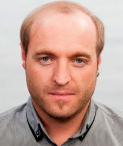 shane before