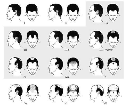 Hamilton Scale B