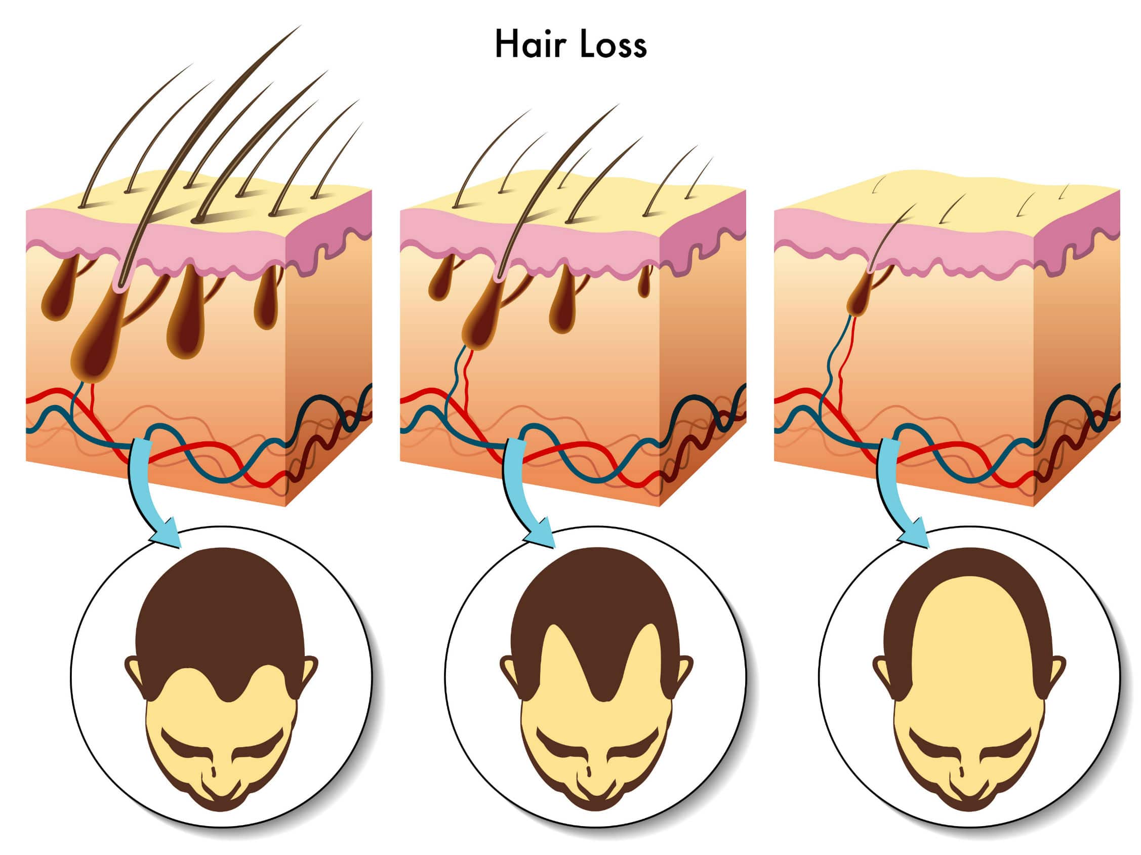 5. How to Prevent Hair Follicle Infections - wide 6
