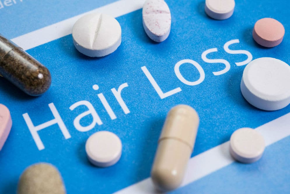 Hair Loss Tablets - Anti-Baldness Treatment in Australia