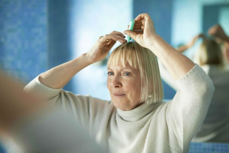 menopause hair loss