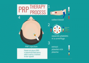 PRP Therapy Process