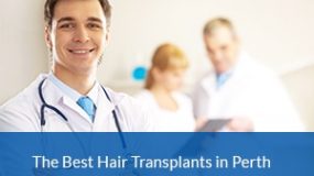 The Best Hair Transplants Perth