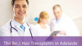 best hair transplants adelaide