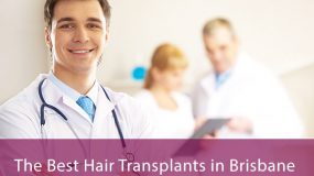 best hair transplants brisbane