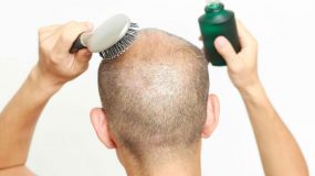Does PRP Work For Hair Regrowth? We Discuss the Results