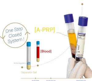 PRP System for Optimal Platelet Recovery