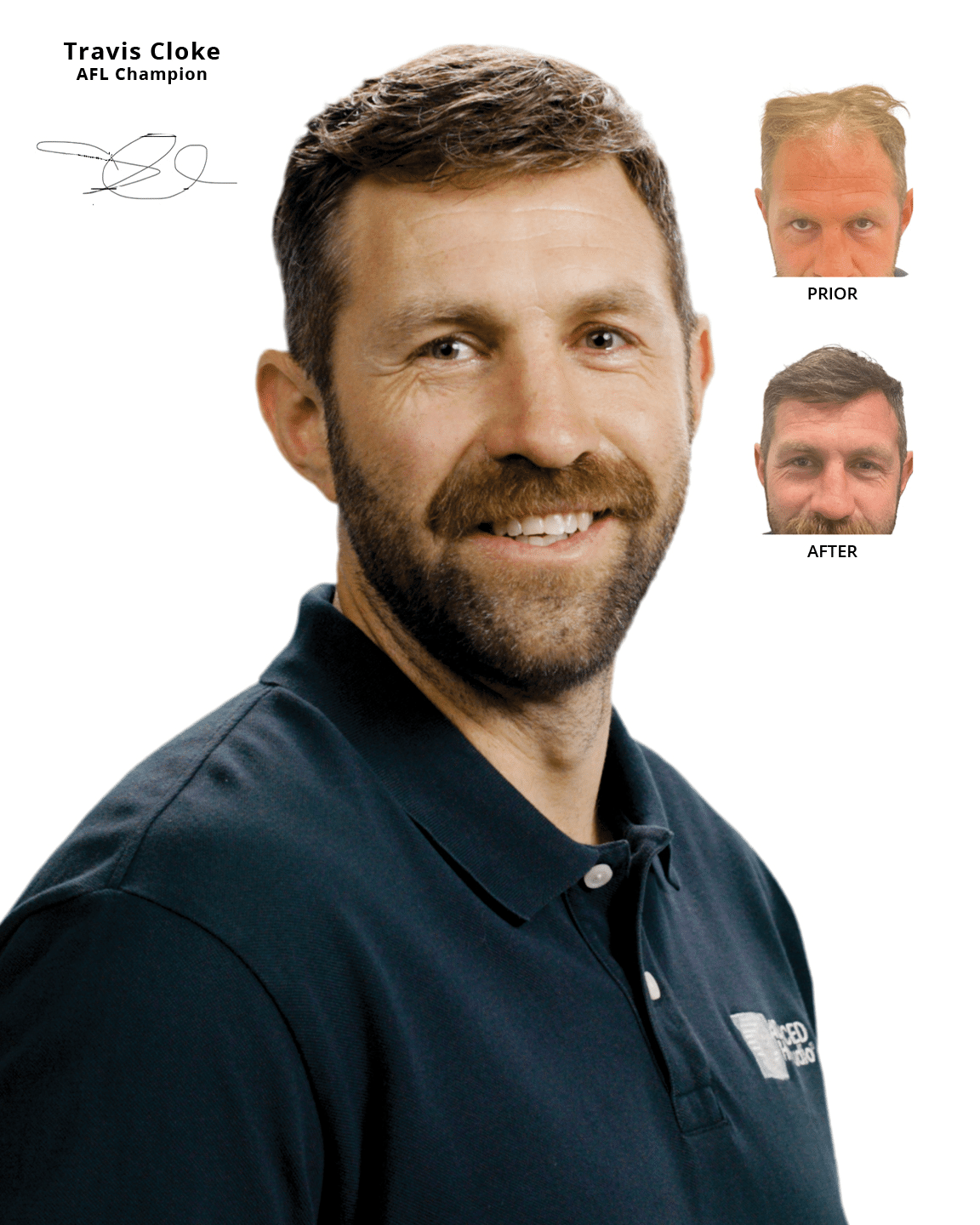 AHS Travis Cloke