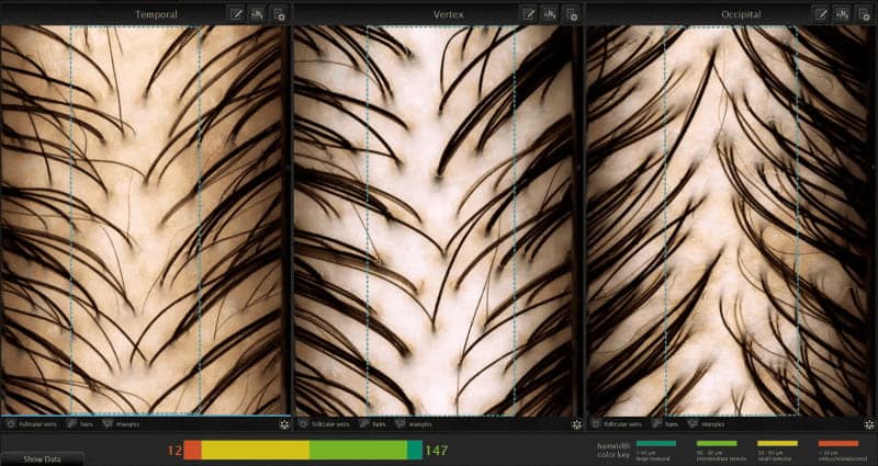 Advanced Hair Analysis