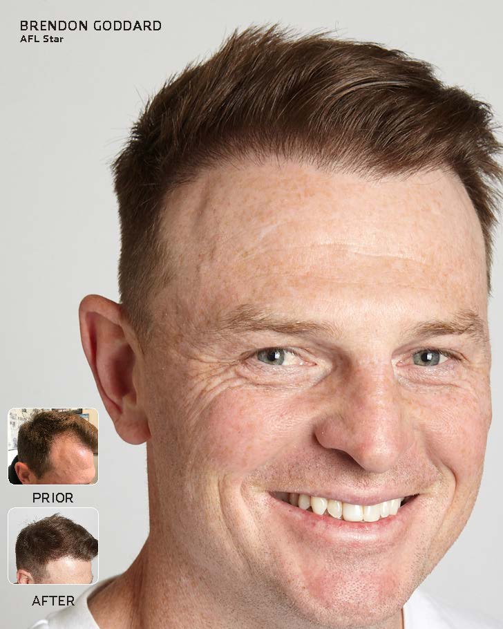 Advanced Hair Brendon Goddard