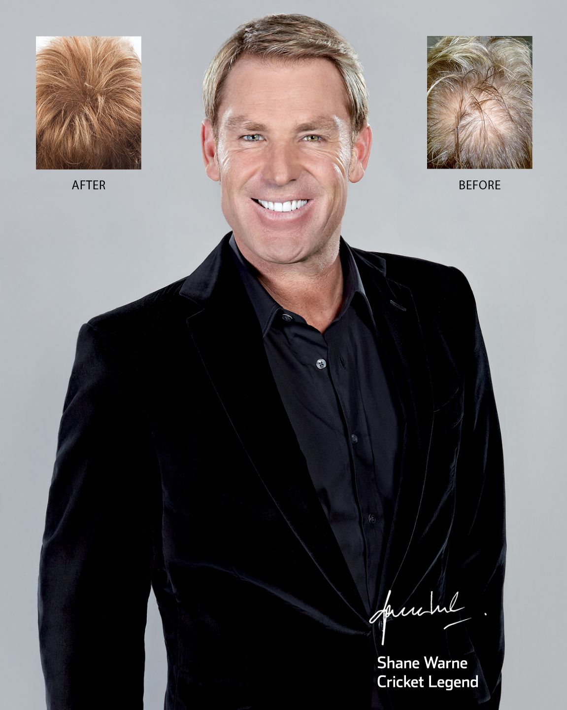 AHS Shane Warne