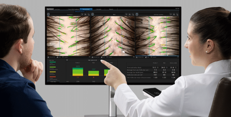 Advanced Hair Consultation Png